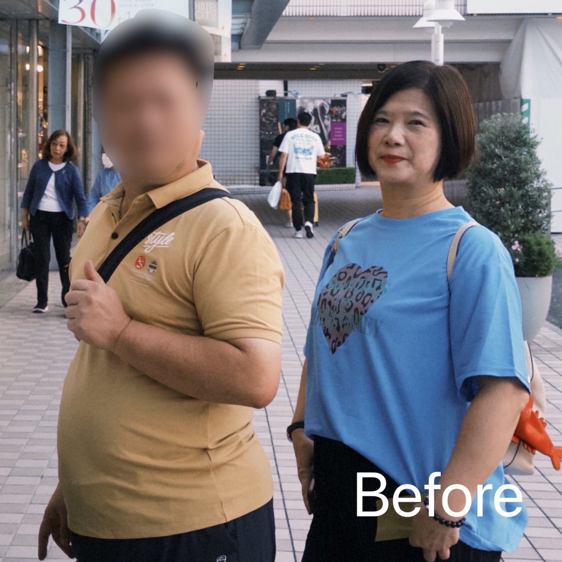 劉小姐減重前